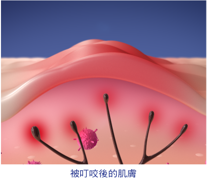 MUHI無比止癢消炎液 商品介紹