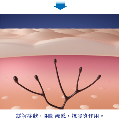 MUHI無比止癢消炎液 商品介紹